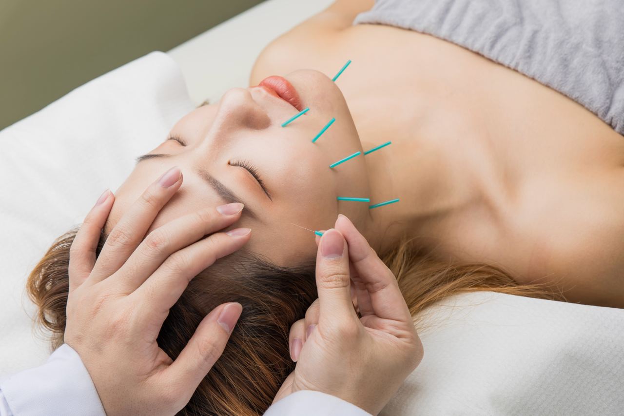 針對美麗再升級：探索中醫美顏針灸的奧秘