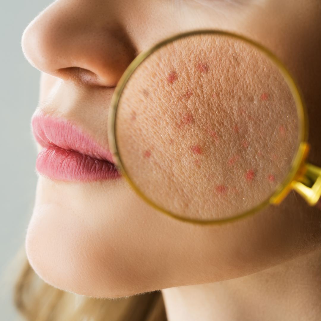 探索中醫皮膚病治療——歸源中醫診所的專業之道